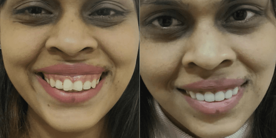 Untitled design - 2026-03-06T115515.691